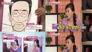 ‘백세인생’ 이애란 “최근 방송활동 많아져 매일 눈화장… 눈 건강 이상”