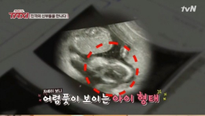정가은, 아기 초음파 사진 공개… “39세에도 임신 가능, 저를 보고 힘 내시라”