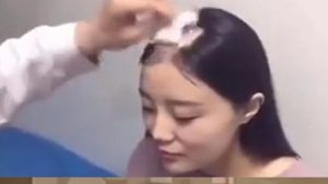 [쿠키영상] 드릴로 옥수수 먹다 앞머리에 '땜빵' 생긴 여성, 의사를 만나다!