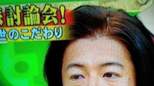 기무라 타쿠야, 급격한 노화로 화제… 
