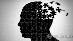 국내 연구진, 뇌파 측정으로 치매 위험군 선별기술 개발