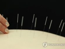 침술·한약으로 게임중독 치료… 효과 두고 논란