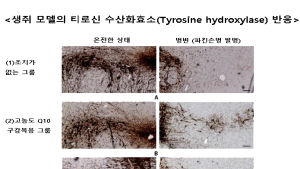 뇌에 직접 항산화제 투여하니 파킨슨병 멈췄다