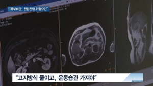 [쿠키건강뉴스] “복부비만 50세 이상 남성, 전립선암 위험 높아”