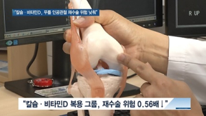 [쿠키건강뉴스] “칼슘·비타민D, 무릎 인공관절 재수술 위험 낮춰”