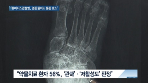 [쿠키건강뉴스] 류마티스관절염, 치료 효과 좋아졌지만 ‘통증 해소’ 숙제