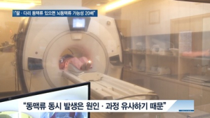 [쿠키건강뉴스] “팔·다리 동맥류 있으면 뇌동맥류 가능성 20배” 