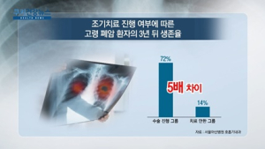 [쿠키건강뉴스] “고령 폐암 환자도 조기치료 받으면 생존율 5배”