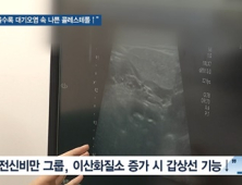 [쿠키건강뉴스] “배 나올수록 대기오염 노출 시 나쁜 콜레스테롤 증가”
