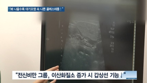 [쿠키건강뉴스] “배 나올수록 대기오염 노출 시 나쁜 콜레스테롤 증가”