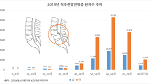 [척리포트] 척추질환 전방전위증 극복, 조기발견 치료에 달렸다 