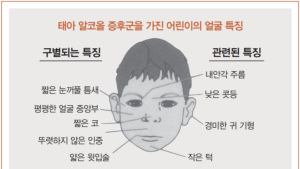 짧은 코⋅낮은 지능⋅정서불안...'임신 중 음주'로 아이가 겪는 문제