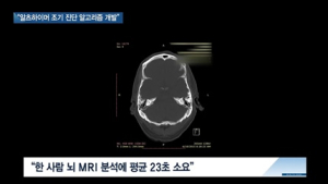 [쿠키건강뉴스] “알츠하이머병 조기 진단 ‘딥러닝 알고리즘’ 개발”