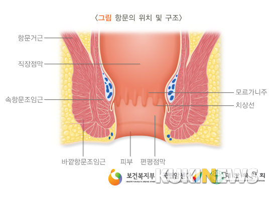 항문의 위치와 구조. 그림=국가건강정보포탈