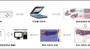 국내 최초 AI 기반 전립선암 진단 소프트웨어 'DeepDx-Prostate' 허가