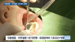 [쿠키건강뉴스] “잇몸염증·치주질환 환자, 감기 환자보다 많아”