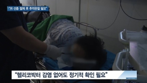 [쿠키건강뉴스] “위 선종, 내시경 절제 후 추적관찰 필요”