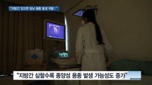 [쿠키건강뉴스] “지방간 있으면 담낭 용종 발생 위험 커져”