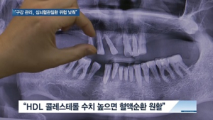 [쿠키건강뉴스] “구강 건강관리, 심뇌혈관질환 위험 낮춰”
