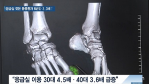 [쿠키건강뉴스] 통풍으로 응급실 찾은 환자 8년간 3.3배 증가