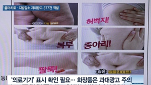 [쿠키건강뉴스] ‘흉터 치료’·‘지방 감소’ 온라인 과대광고 377건 적발