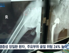 [쿠키건강뉴스] “염증성장질환 환자, 척추·고관절 골절 위험 더 높아”