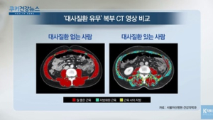 [쿠키건강뉴스] “지방 적은 질 좋은 근육 많으면 대사질환 위험 낮아”