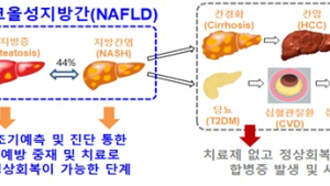 '비알코올성 지방간' 심하면 10년 내 심혈관계질환 위험 4~5배 ↑
