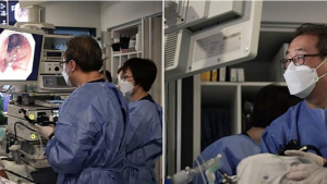 장재영 경희대병원 교수 “내시경 통해 조기 식도암 정복… 환자 부담감↓·치료효과↑”