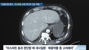 [쿠키건강뉴스] “B형간염 환자, 아스피린 장기 복용하면 간암 위험 감소”