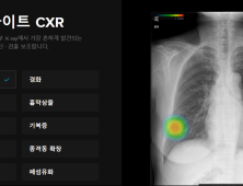 ‘보험 진입’ 2번째 혁신의료기술…루닛이 선점할까