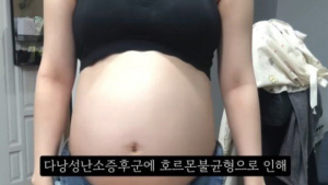 의협회장 “36주 태아 낙태, 천인공노할 일…엄중 징계 할 것”