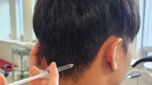차사고로 생긴 두통에 한방 약침 효과적 [건강 나침반]
