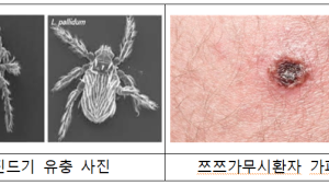 ‘야외활동 시 쯔쯔가무시증 주의’...