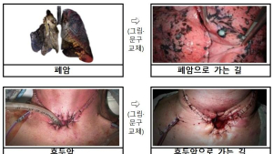 ‘폐암으로 가는 길’…담뱃갑 경고 그림·문구 강화