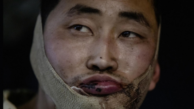 우 “생포한 북한군 교환” 제의에 러 “논평 불가”