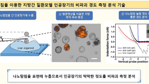 [쿠키과학] 소리 없는 암살자 '지방간', 초정밀 나노탐침으로 찾는다