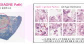 LG, 차세대 정밀 의료 AI ‘엑사원 패스 2.0’ 공개…“암 정복 나선다”