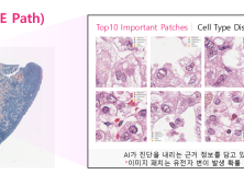 LG, 차세대 정밀 의료 AI ‘엑사원 패스 2.0’ 공개…“암 정복 나선다”