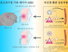 [쿠키과학] IBS '뇌 속 혈류 조절의 열쇠' 억제성 신경세포에서 찾다