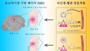 [쿠키과학] IBS '뇌 속 혈류 조절의 열쇠' 억제성 신경세포에서 찾다