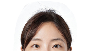 중앙대병원 박귀영 교수팀, CaHA 필러 ‘목주름·안면노화 개선’ 효과 규명